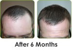 Hair Loss Laser Group 378066 Image 0
